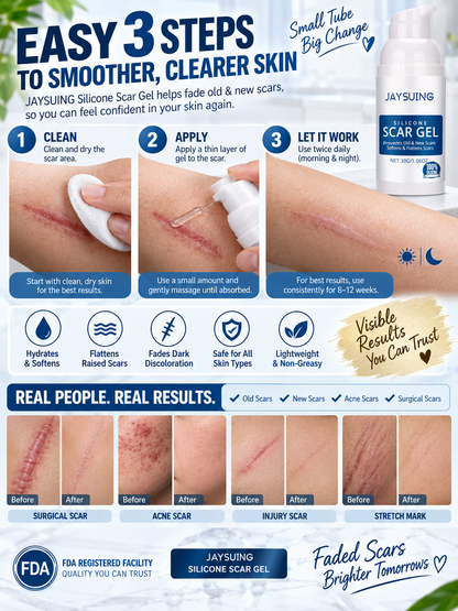 ✨ Advanced Silicone Scar Gel | Smooth & Soften Scars.-OKL