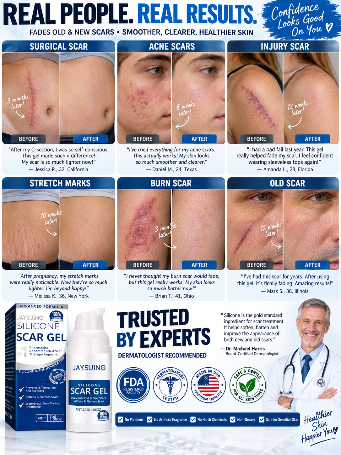 ✨ Advanced Silicone Scar Gel | Smooth & Soften Scars.-OKL