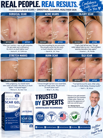 ✨ Advanced Silicone Scar Gel | Smooth & Soften Scars.-OKL